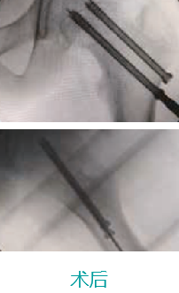 1642581747251333.png image.png